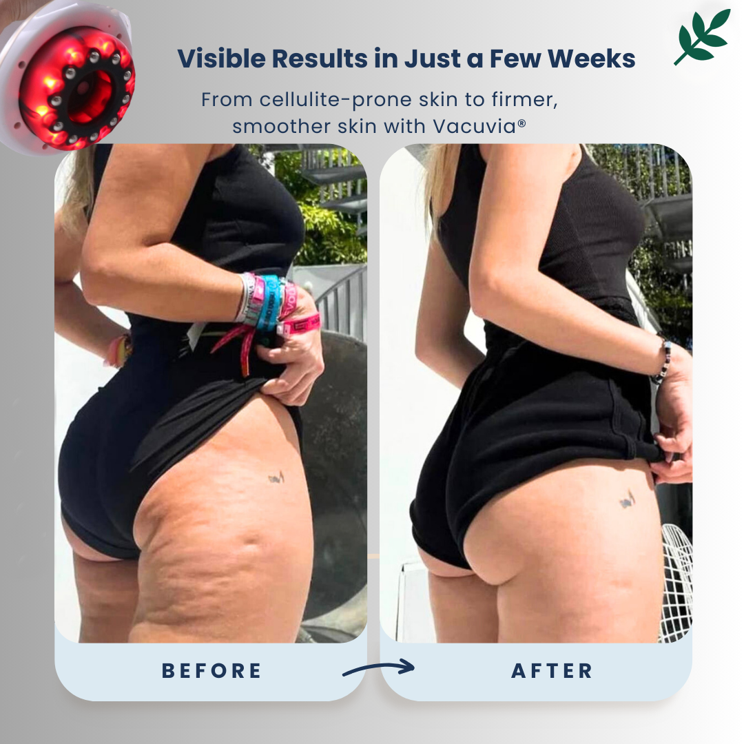 SculptGlow™ – Firmer, More Toned Skin