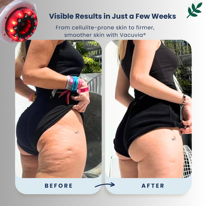 SculptGlow™ – Firmer, More Toned Skin